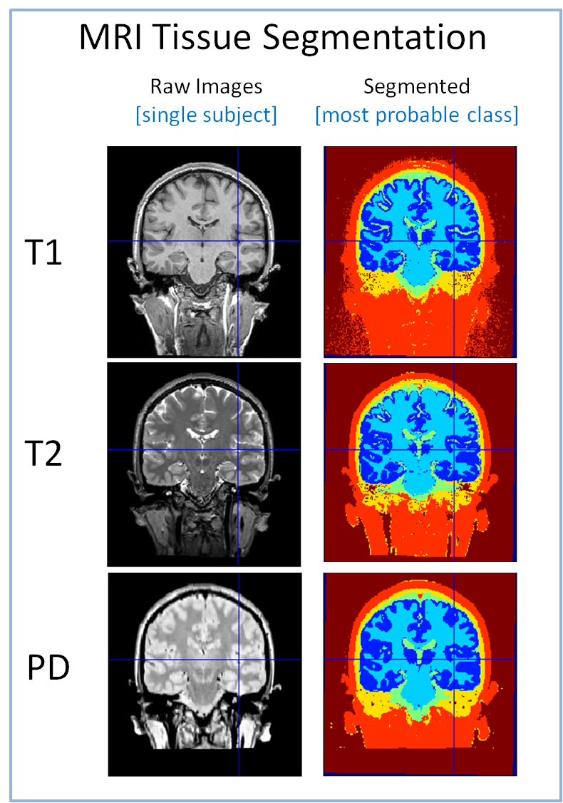 neurostr image 1