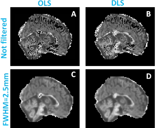 neurostr image 2